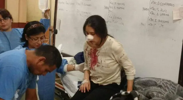 Chimbote: Sujeto golpeó salvajemente en el rostro a su esposa