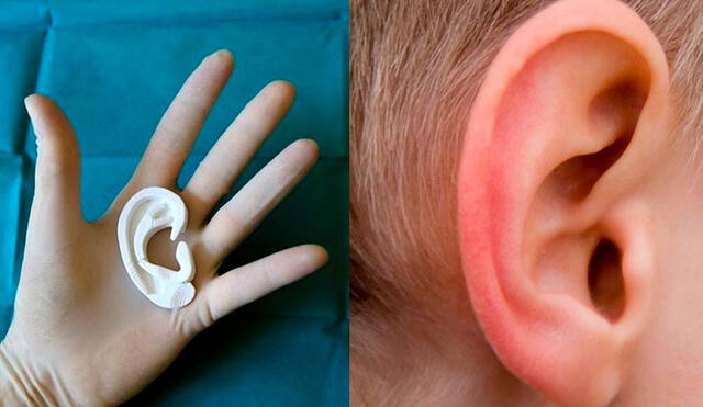 Médicos italianos logran darle sus primeras orejas a un niño que sufre microtia. Fotos Notiziedi / referencial.