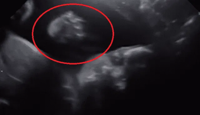 YouTube: momento exacto en que bebé "saluda" durante ecografía [VIDEO]