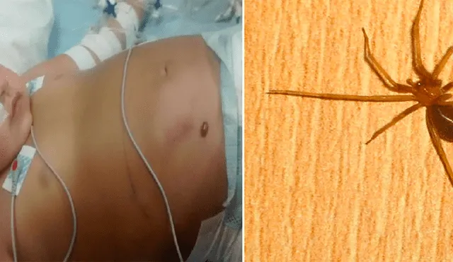 En terapia intensiva quedó una niña de 3 años por picadura de una araña de rincón [VIDEO]