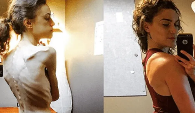 Instagram: mujer que sufrió anorexia comparte su increíble transformación  [FOTOS]