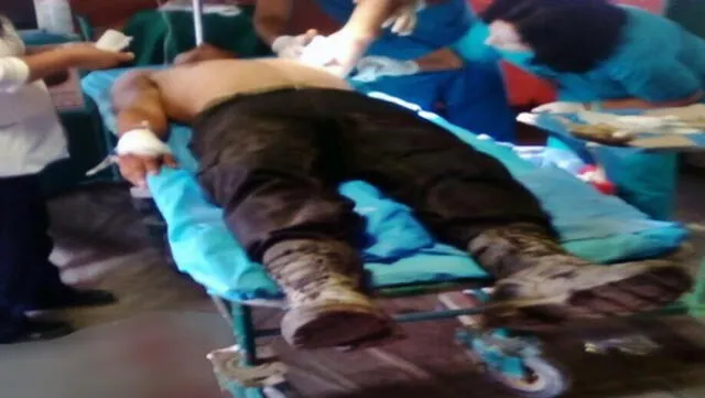 Huarmey: enfrentamientos deja a policía herido de bala en el brazo 