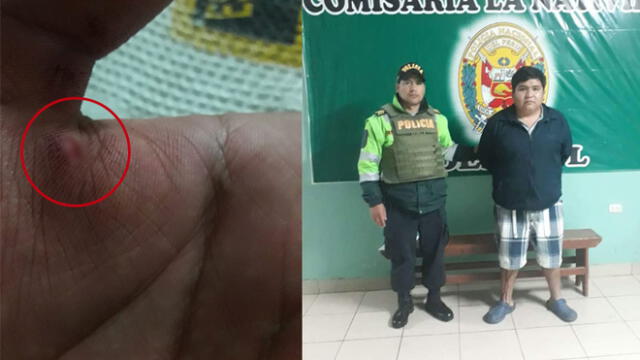Sujeto agrede a mordidas a policía que lo intervino en Tacna 