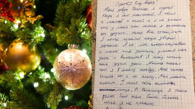 Carta de Navidad: niño que sobrevivió incendio y quedó desfigurado pide nuevo rostro a Papa Noel