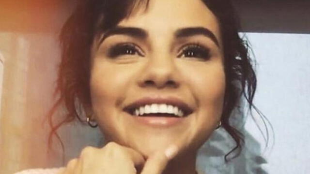 Selena Gomez luce increíble transformación en sus dientes chuecos