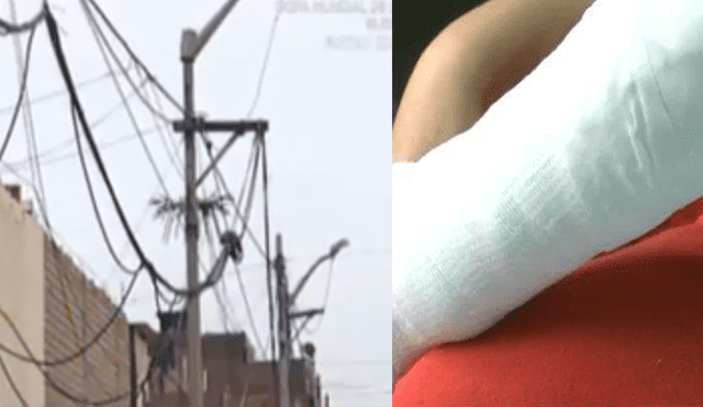 Callao: Niña sufre quemaduras tras caerle cable eléctrico [VIDEO]