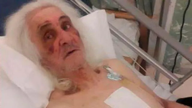 Anciano sufre brutal golpiza a martillazos por parte de ladrones