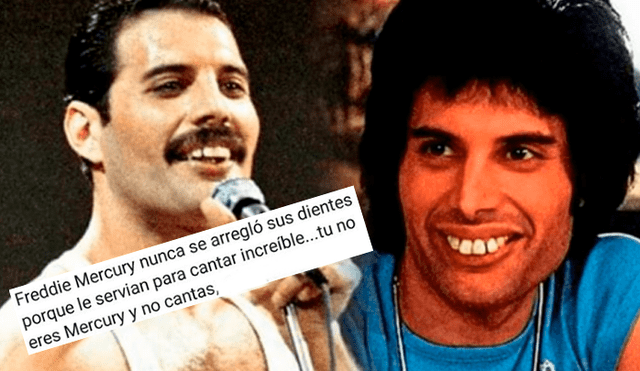 Facebook: Clínica dental trolea a usuarios al recordar sonrisa de Freddie Mercury [FOTO]
