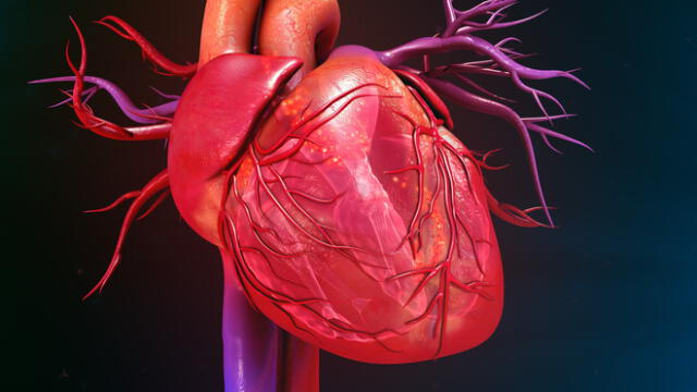 El COVID-19 tiene capacidad para inflamar el tejido cardiaco (miocarditis).
