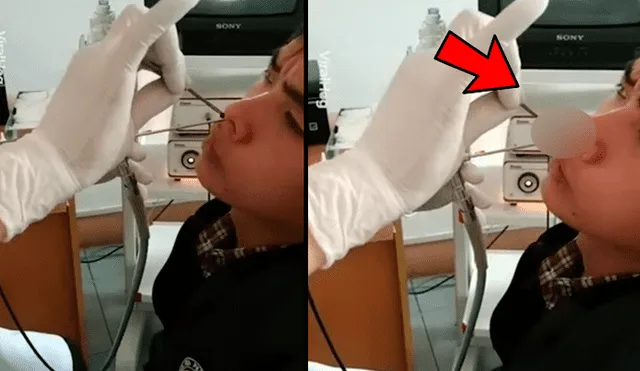 Facebook viral: misteriosa criatura que resistía abandonar nariz de joven provoca espanto [VIDEO]