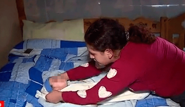 Puente Piedra: bebé invidente que sufre de convulsiones necesita ayuda [VIDEO]