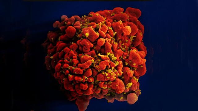 Imagen microscópica de una célula T infectada con VIH. Foto: NIAID