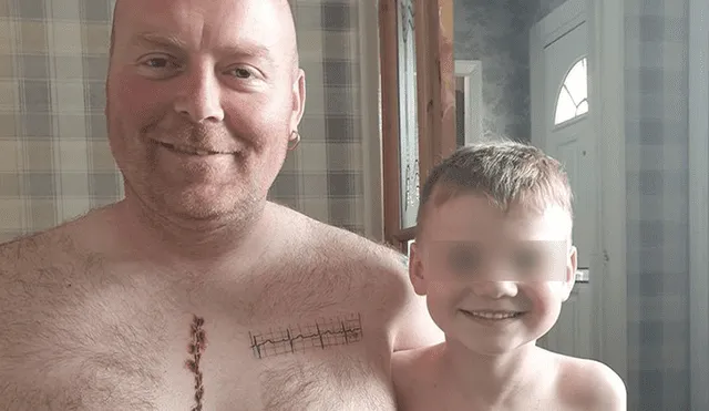 Padre se tatuó cicatriz en solidaridad con su pequeño hijo. Foto: Facebook