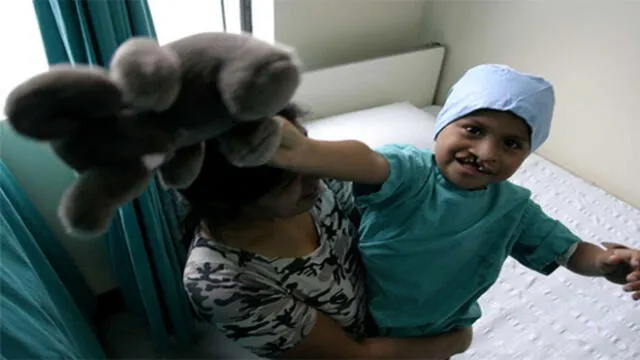 Más de 80 niños y adultos con labio leporino serán operados gratis en Cusco