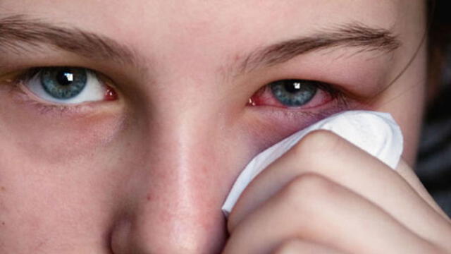 Piscinas contaminadas podrían provocar infecciones en los ojos