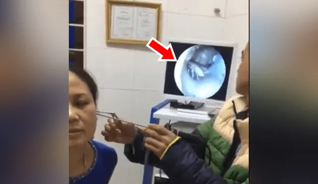Facebook viral: Siente extraños movimientos en oído, doctor la revisa y saca enorme criatura [VIDEO] 