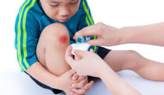 Sepa cómo tratar seis tipos de heridas comunes entre los niños