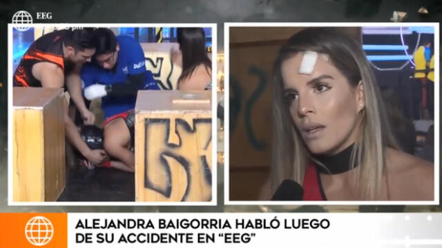 Alejandra Baigorria tiene cuatro puntos en el rostro tras sufrir fuerte lesión en EEG