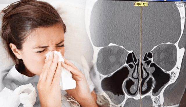 EE.UU.: pensó que era gripe, pero lo que tenía pudo acabar con su vida