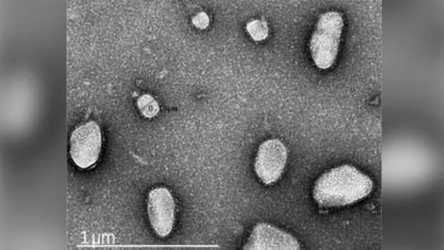 Imagen de las partículas 'imitadoras' del SARS-CoV-2 bajo microscopio electrónico. Crédito: City College of New York.