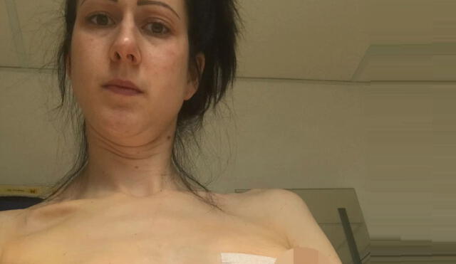 Hannah Packham revela su drama tras someterse a un aumento de senos. Foto: Difusión.