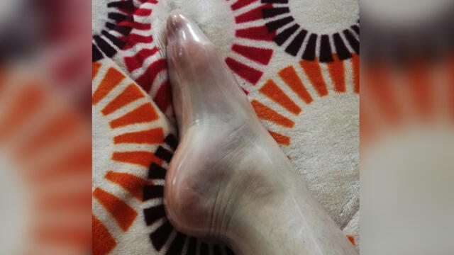Joven se puso un condón en el pie y lo compartió en sus redes sociales. (Foto: Twitter (@valespinolaa)