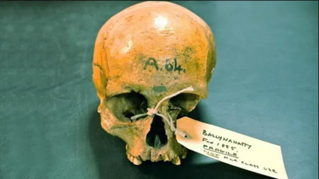 Cráneo de una mujer del Neolítico hallado en Ballynahatty, Irlanda del Norte. Foto: referencial / Trinity College de Dublín