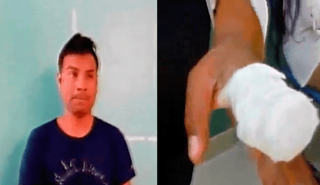 Puente Piedra: tras ser detenido, sujeto arranca parte del dedo a policía [VIDEO]