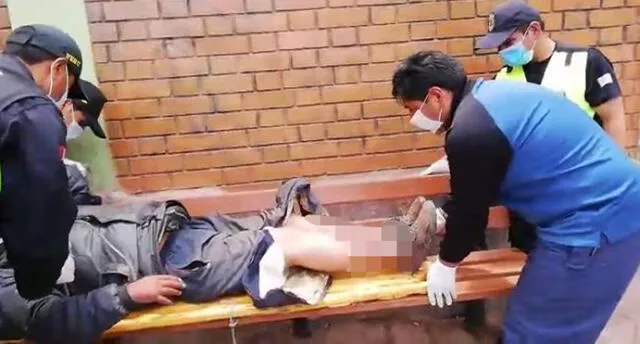 Cusco: auxilian a indigente de 55 años con piernas gangrenadas y agusanadas [VIDEO]
