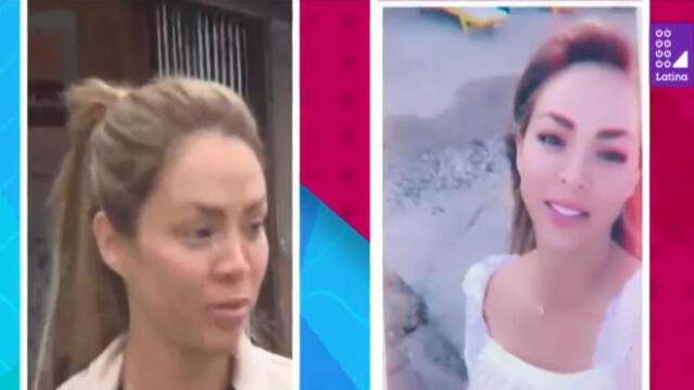 Sheyla Rojas sufre transformación en su rostro tras viaje con millonario