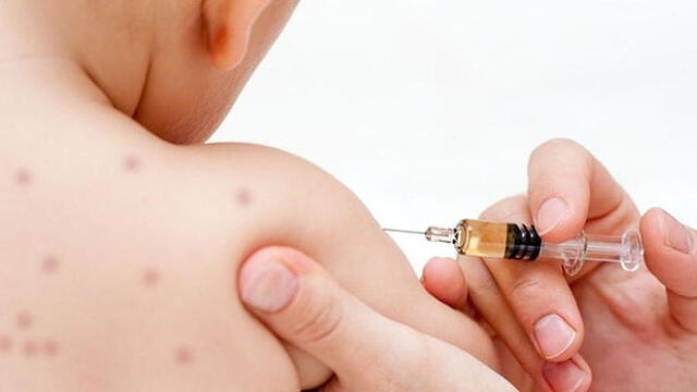 Estados Unidos es el país más rico con más niños sin vacunar contra el sarampión
