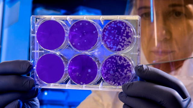 Científicos descubren el origen de la metástasis y están más cerca de la cura contra el cáncer