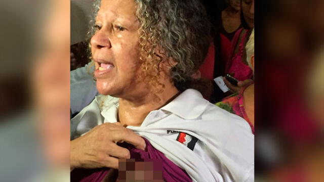 Elizabeth Salazar denunció públicamente la crisis hospitalaria en Venezuela al no recibir un tratamiento adecuado para su cáncer de mama. Foto: Difusión