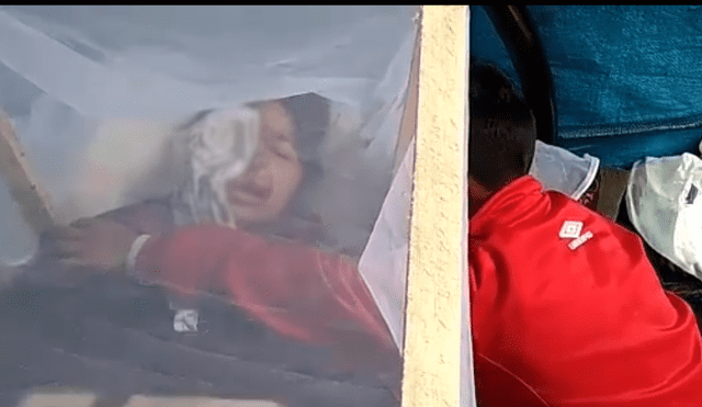 Huancayo: mujer que presenta un orificio en el rostro fue hospitalizada por melanoma maligno