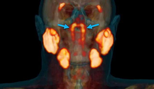 Las glándulas salivales tubariales humedecen y lubrican la parte superior de la garganta | Foto: Instituto del Cáncer de los Países Bajos