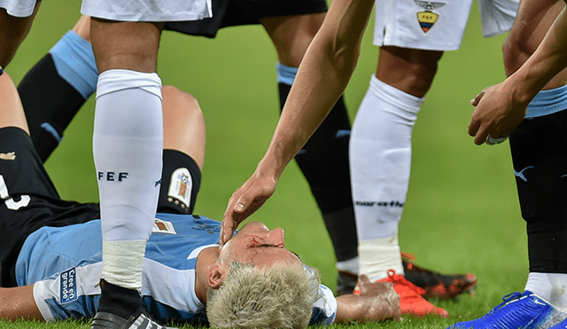 Uruguay vs Ecuador: terrible codazo de José Quinteros contra Lodeiro que terminó en expulsión