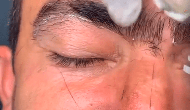 Facebook viral: hombre con las cejas ‘pobladas’ se somete a drástico cambio de ‘look’ y resultado cautiva a miles