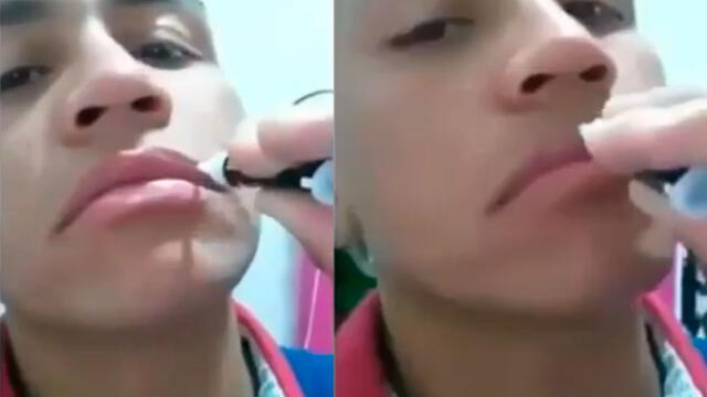 Vía Facebook: se coloca pegamento en los labios para besar a su novia y así terminaron [VIDEO]