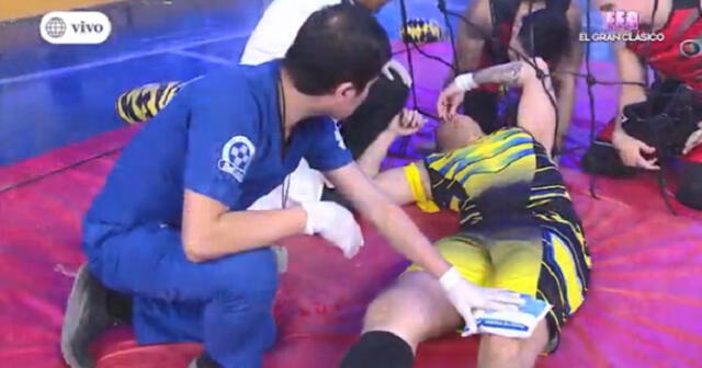 Esto es Guerra: Krayg Peña asusta a sus fans con fuerte lesión [VIDEO]