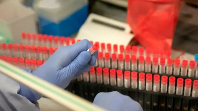 Un científico de laboratorio médico analiza muestras de COVID-19 en un laboratorio de virología. Foto: AFP.