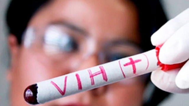 Chiclayo: realizarán maratón de despistajes gratuitos de VIH, Sífilis y Hepatitis B