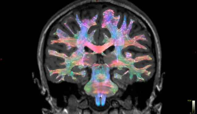 La nueva membrana descubierta protege al cerebro de infecciones y otras amenazas. Foto: referencial / Florey Institute