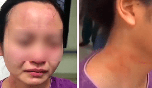 Paciente con coronavirus golpeó a una enfermera y le mordió en la cara para escapar de la cuarentena. (Foto: Captura)