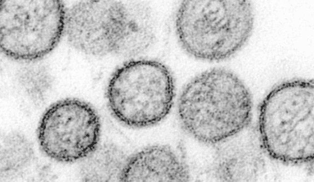 Se confirmó la primera muerte por fiebre hemorrágica en Brasil, después de más de 20 años. El paciente era portador del arenavirus. (Foto: Internet)