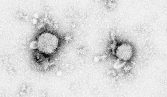 El Arenavirus ha cobrado la vida de tres personas desde mayo. Foto: Wikipedia.