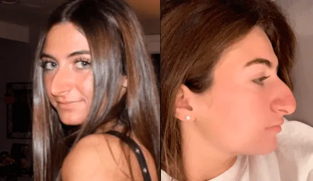 La joven mostró el antes y el después de su operación en la nariz y ahora luce totalmente diferente. Foto: captura
