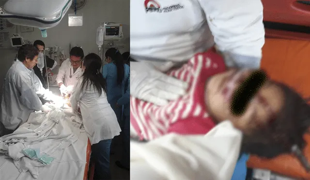 Huancayo: Niña termina con la cabeza incrustada por un fierro tras caer de azotea