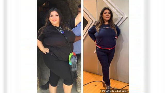 Antes y después de la abogada y vedette Lucy Cabrera  tras perder peso con la banda gástrica. Fuente: Instagram