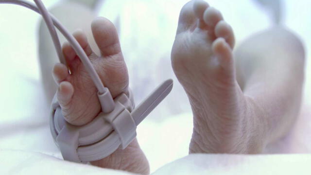 Las autoridades de Portugal investigan el caso de negligencia que ocasionó el nacimiento del ''bebé sin rostro''. Foto: Referencial