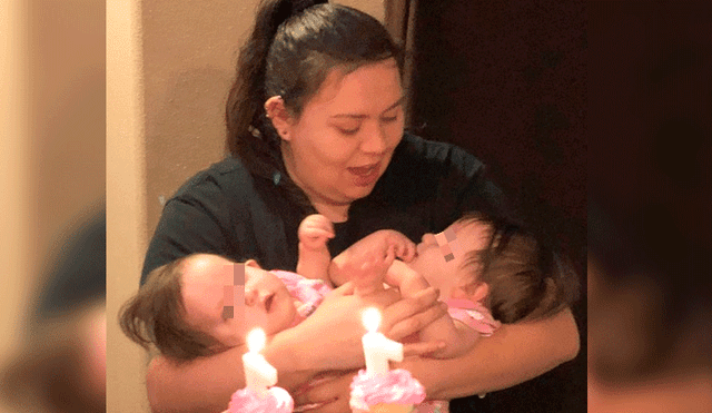 Mamá de siamesas se niega a separarlas pese a que los médicos le pidieron abortarlas